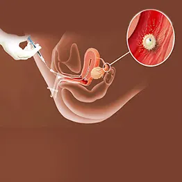 Infertility Specialist in Moshi